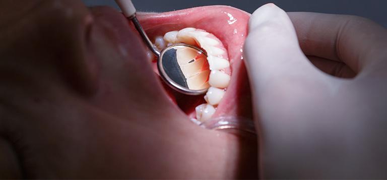 szczotki do żębów